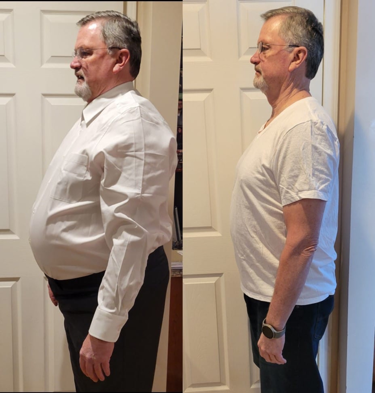 Apex client transformation